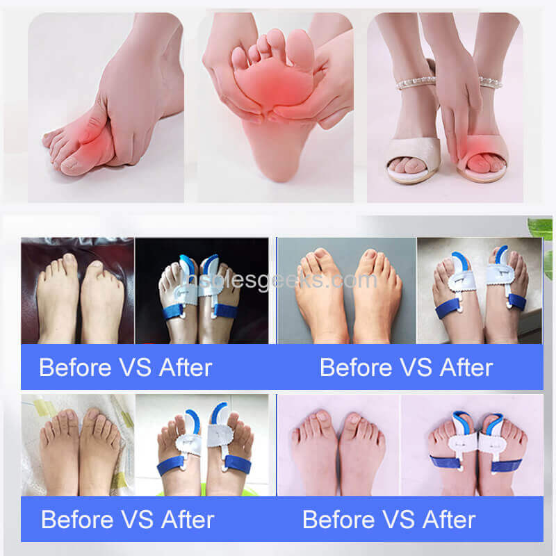 Bunion Regulato Hallux Valgus Guard Foot Care HAV Splint